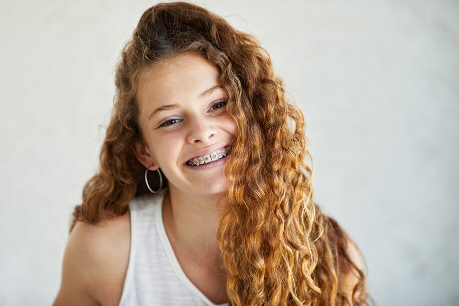 4 Benefits of SureSmile Aligners Over Traditional Braces